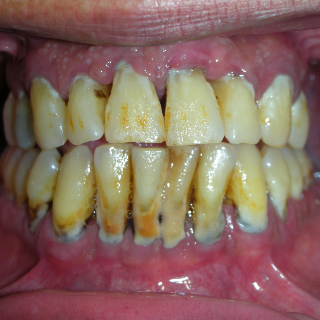 Mondzorg voor optimale mondhygiëne door Mondzorg Diamant